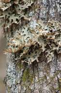 Image of lung lichen