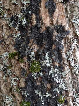 Image of skin lichen