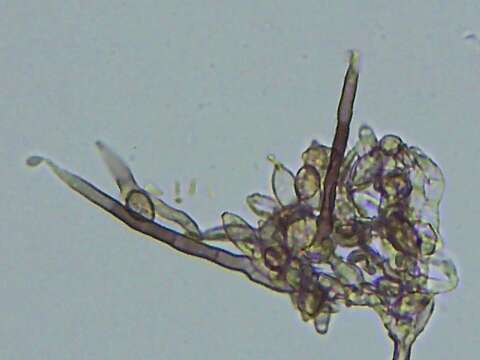 Image of Pseudallescheria boydii (Shear) McGinnis, A. A. Padhye & Ajello 1982