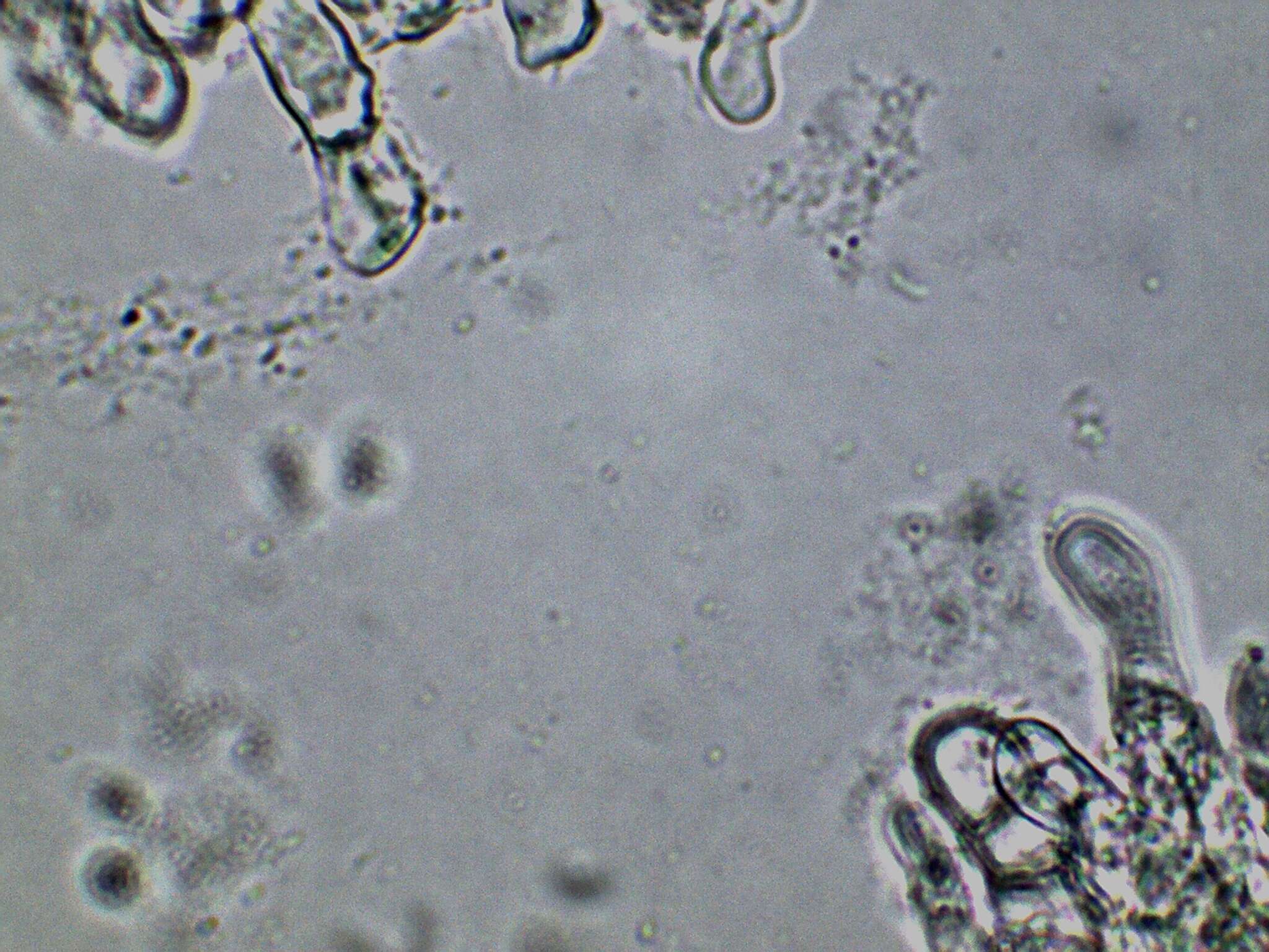 Imagem de Pachyella celtica (Boud.) Häffner 1993