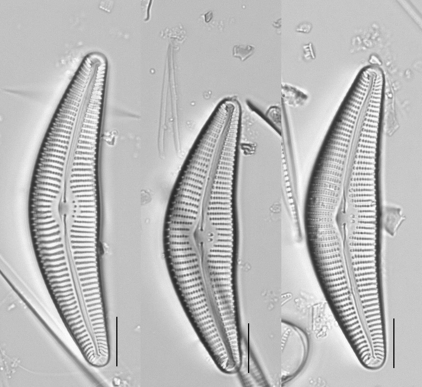 Image de <i>Cymbella neocistula</i> var. <i>islandica</i> Krammer 2002