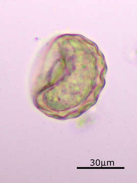 Image of Arcella gibbosa