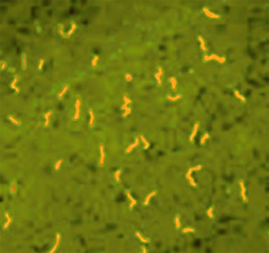 Image of Borrelia