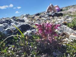 Image of mountain lousewort