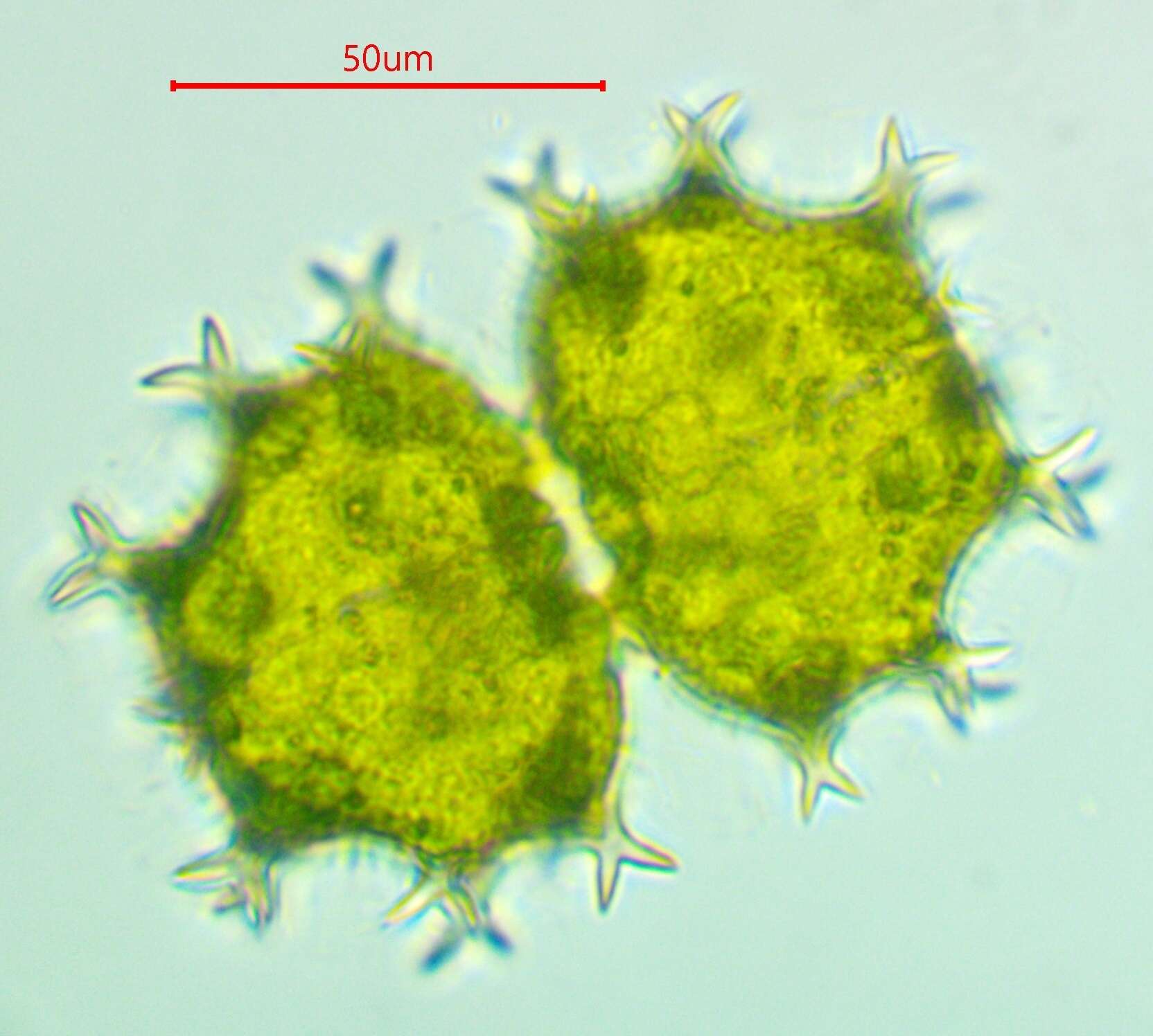 Image of Xanthidium armatum