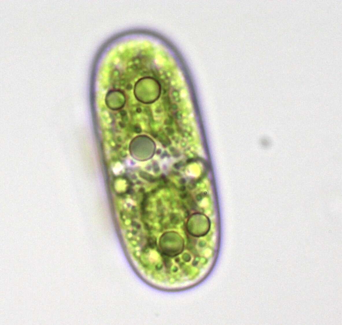 صورة Cylindrocystis brebissonii