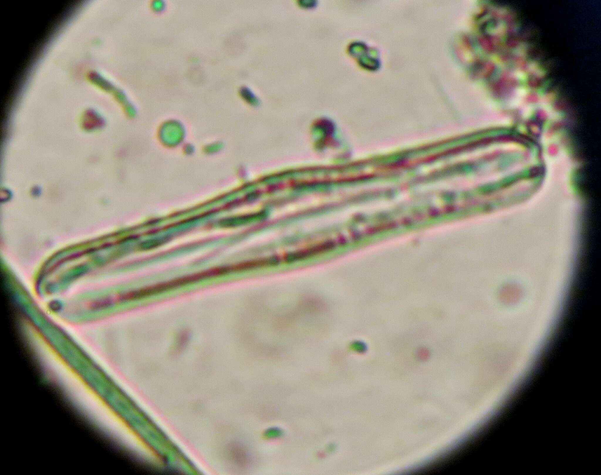 Image of <i>Epithemia gibba</i> Kützing