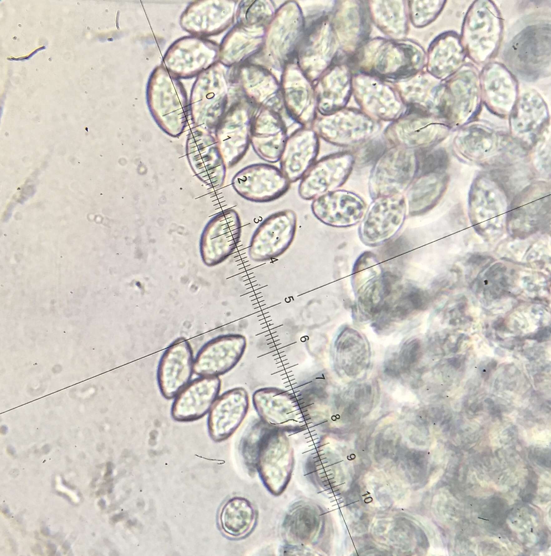 صورة Trichocladium