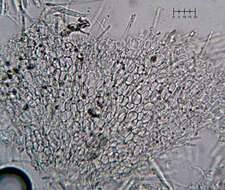 Plancia ëd Eupezizella aureliella (P. Karst.) T. Kosonen, Huhtinen & K. Hansen