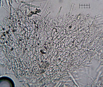 Plancia ëd Eupezizella aureliella (P. Karst.) T. Kosonen, Huhtinen & K. Hansen