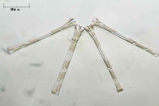 Image of Asterionella