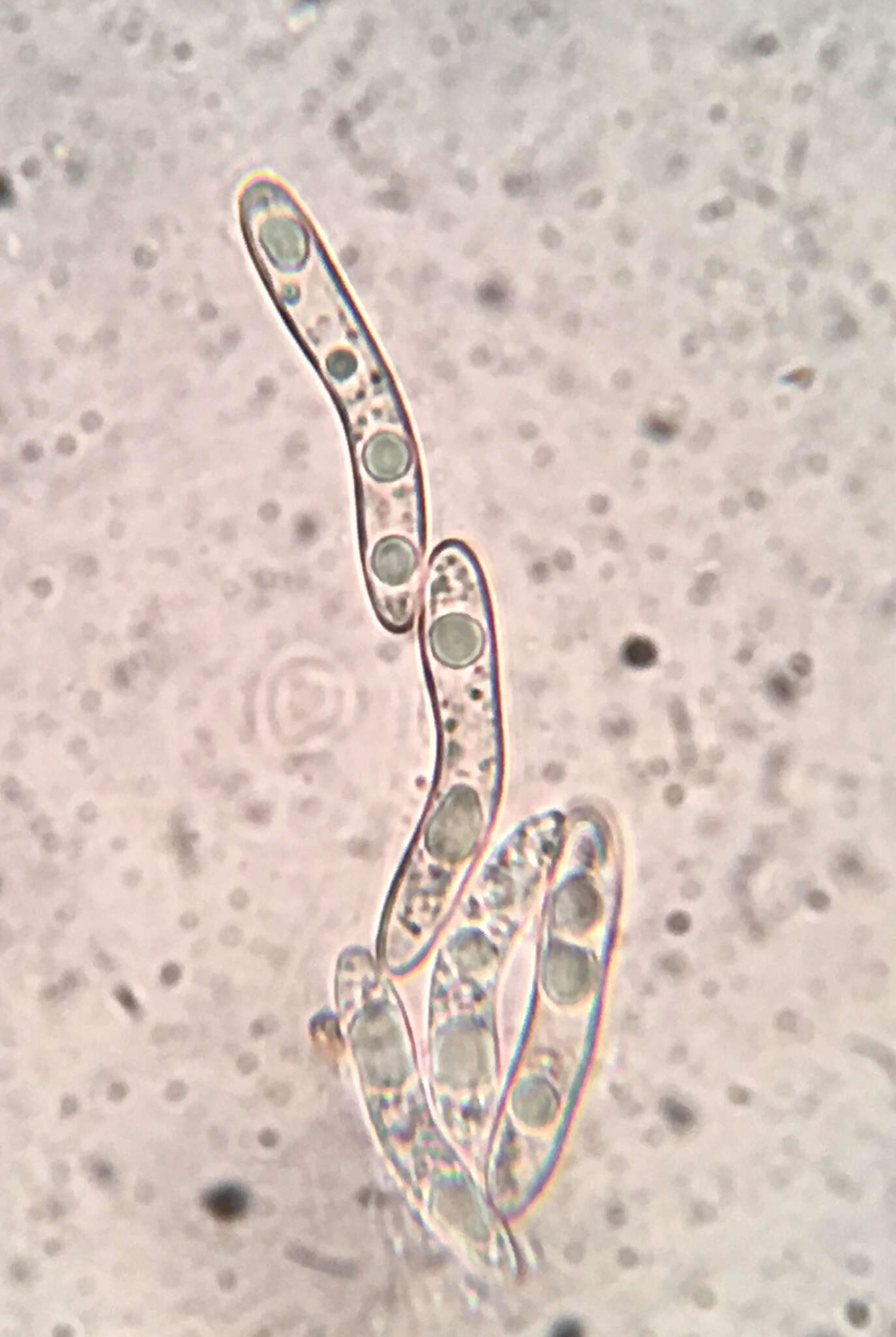 Echinosphaeria strigosa (Alb. & Schwein.) Declercq 2009的圖片