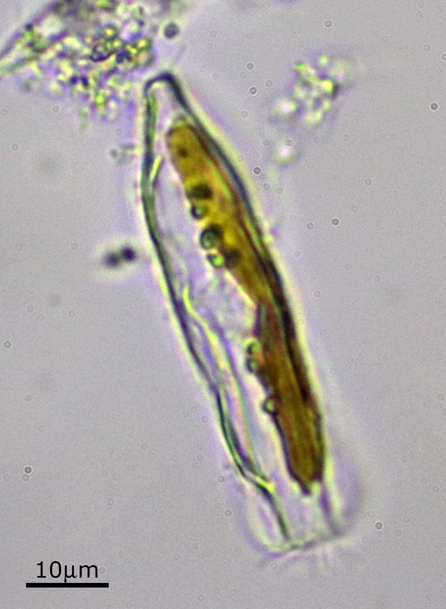 Image of Entomoneis paludosa