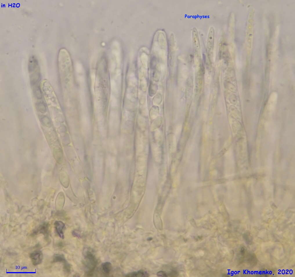 Image of Lachnellula agassizii (Berk. & M. A. Curtis) Dennis 1962