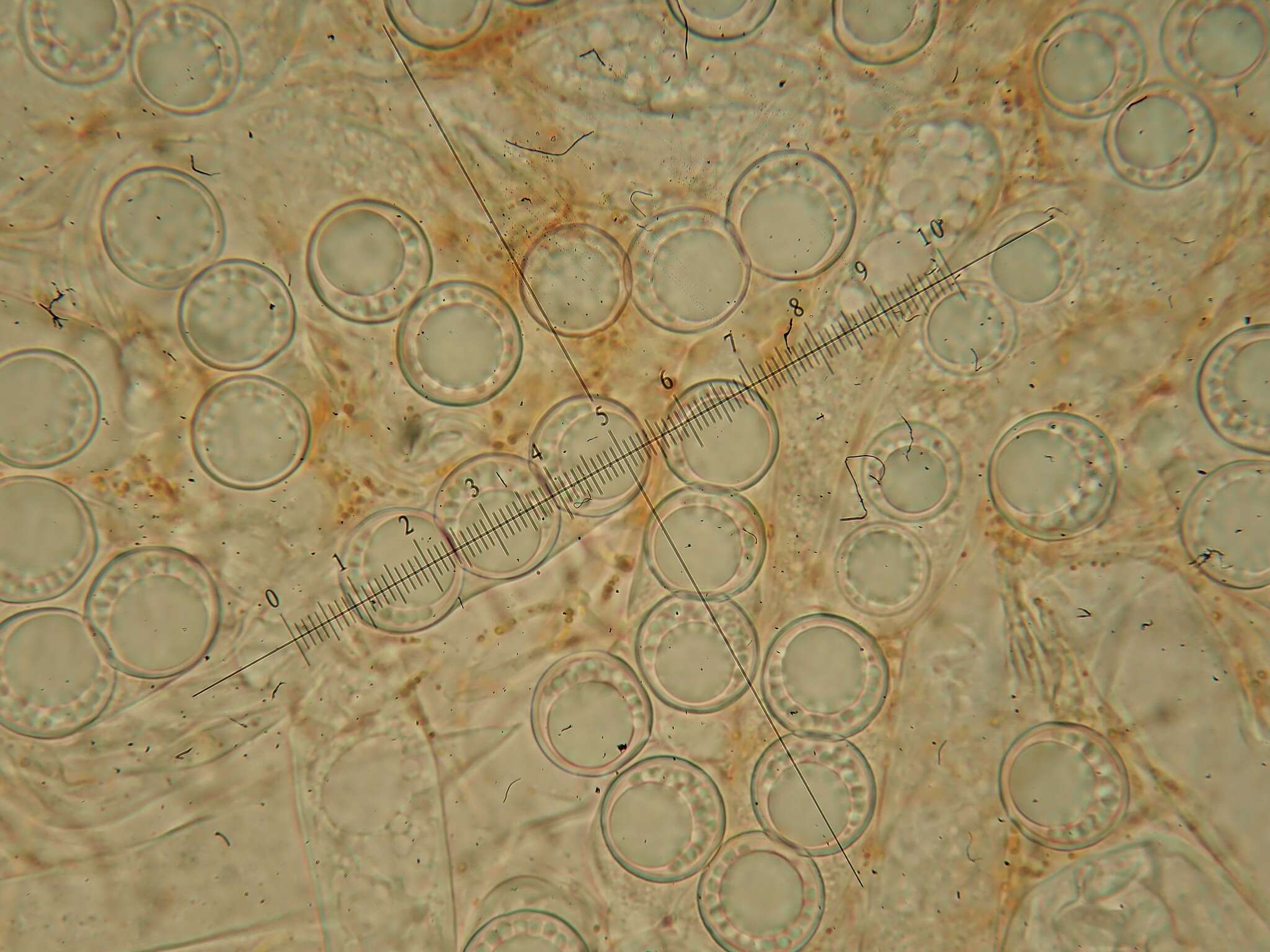 Sivun Pulvinula convexella (P. Karst.) Pfister 1976 kuva