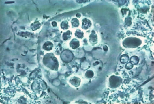 Image of <i>Entamoeba gingivalis</i>