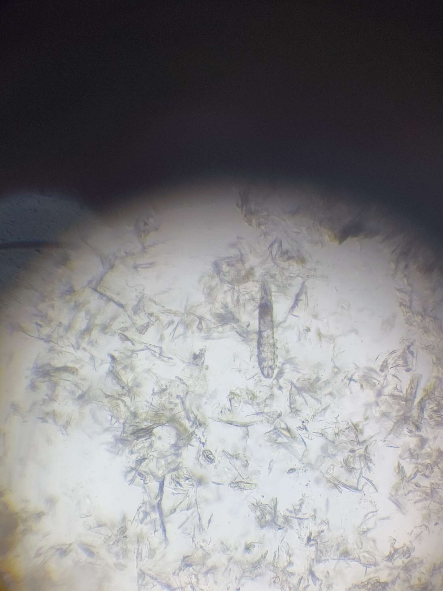 Sivun Demodex canis Leydig 1859 kuva