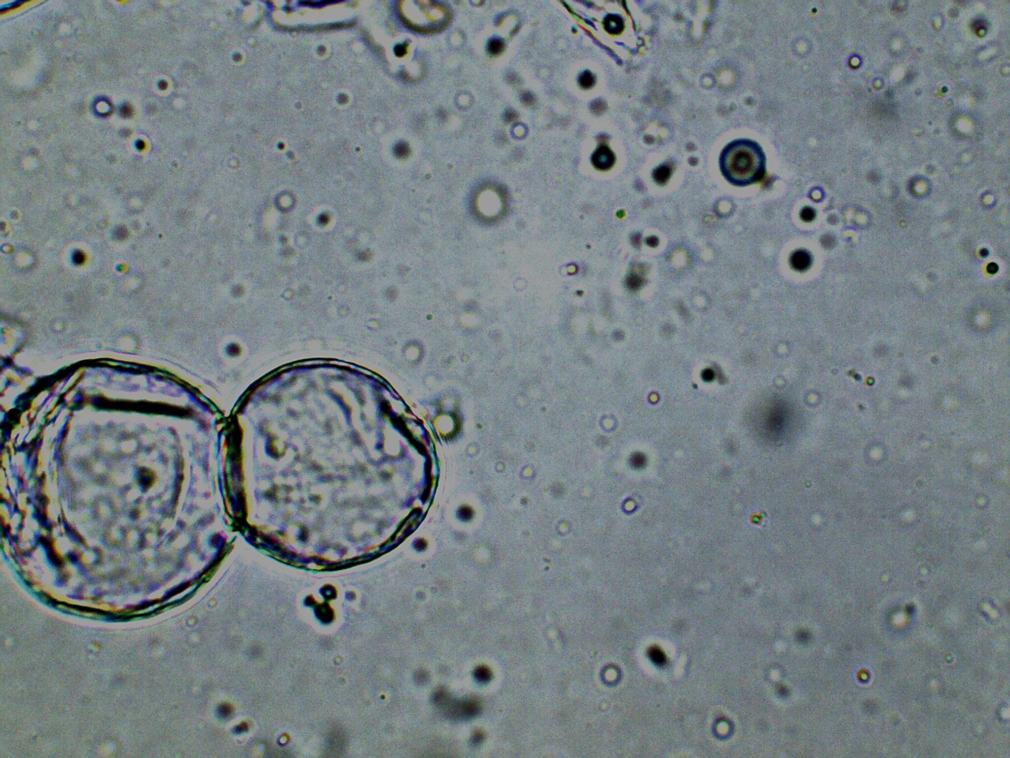 Image of Cystolepiota seminuda (Lasch) Bon 1976