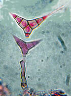 Image of Diplocladiella scalaroides G. Arnaud ex M. B. Ellis 1976