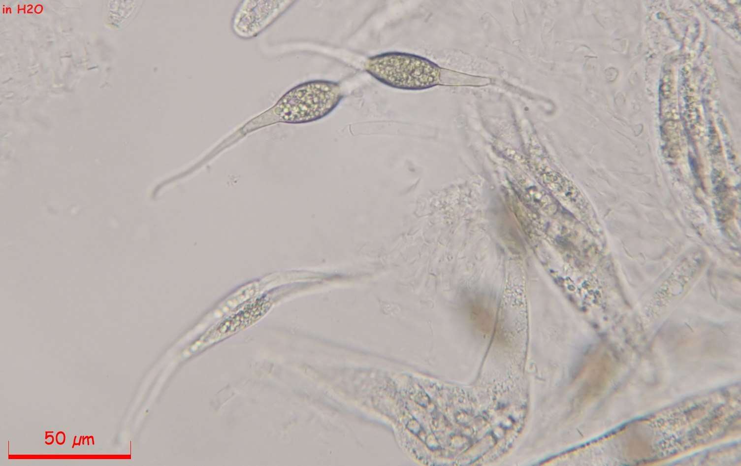 Image of Podospora appendiculata (Auersw. ex Niessl) Niessl 1883