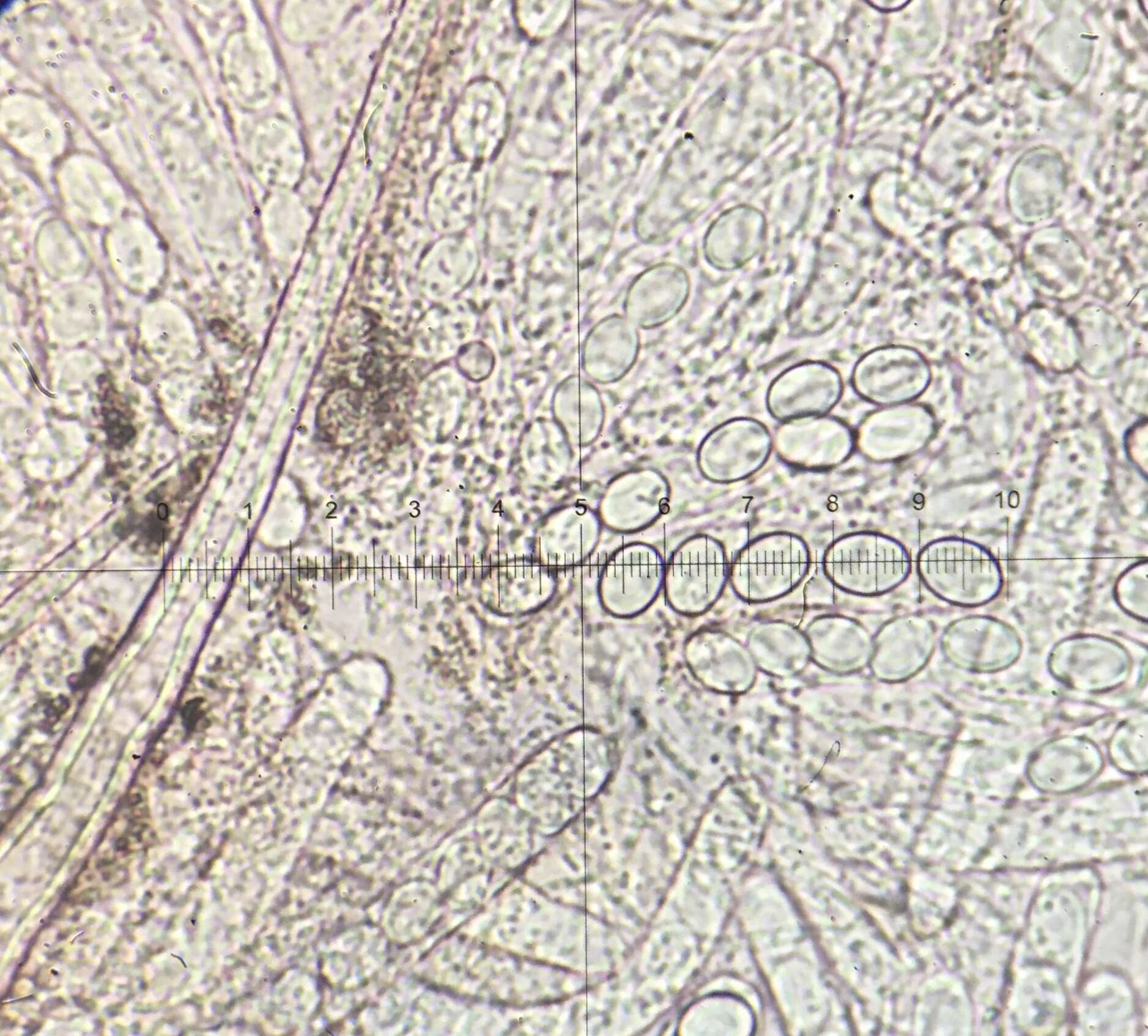 Image de Lasiobolus microsporus J. L. Bezerra & Kimbr. 1975