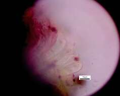 Image of <i>Bachmanniomyces punctum</i> (A. Massal.) Diederich & Pino-Bodas