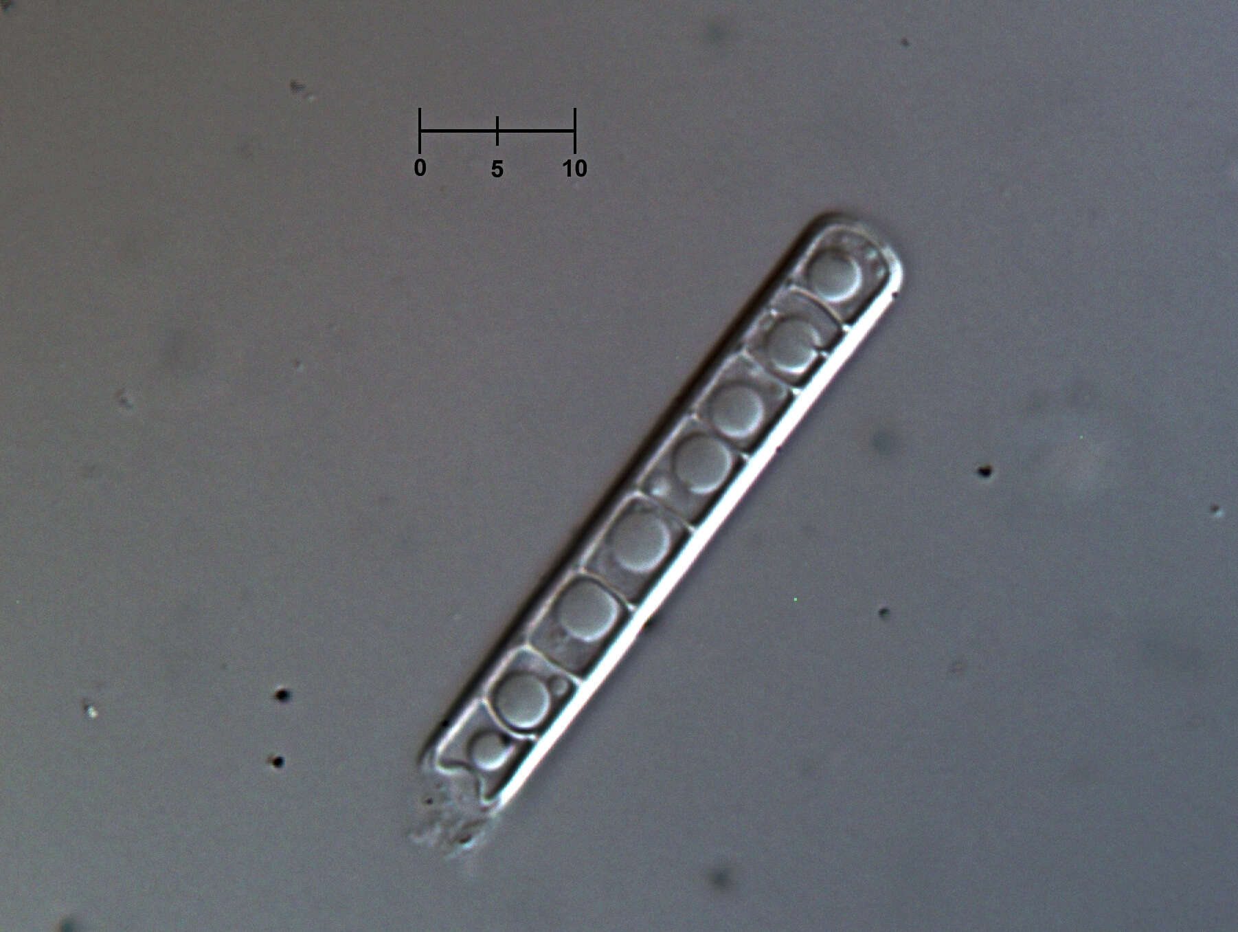 Chalara insignis (Sacc., M. Rousseau & E. Bommer) S. Hughes 1953 resmi