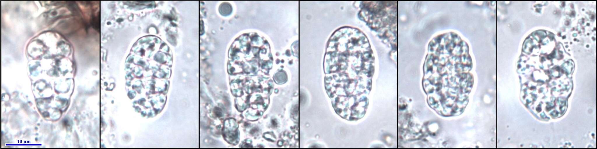 Imagem de Rhizocarpon petraeum (Wulfen) A. Massal.