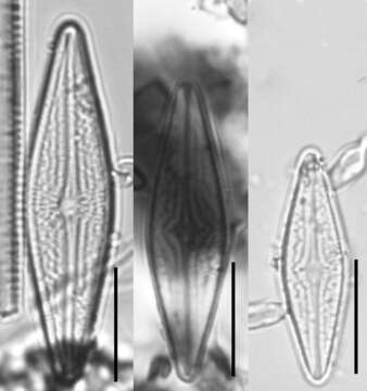 Image of Brachysira brebissonii R. Ross 1986