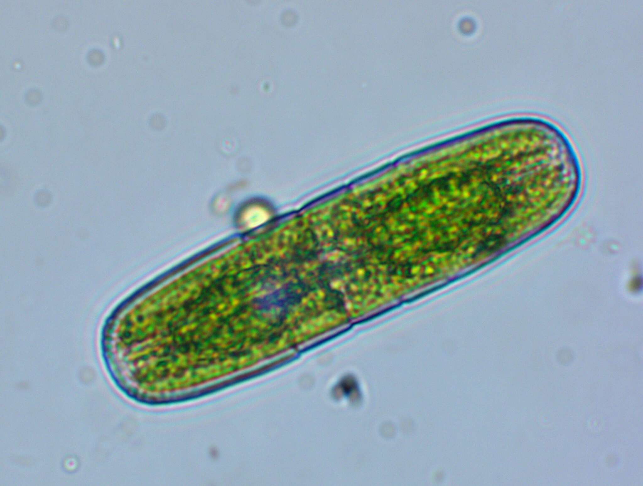 Image of Penium margaritaceum