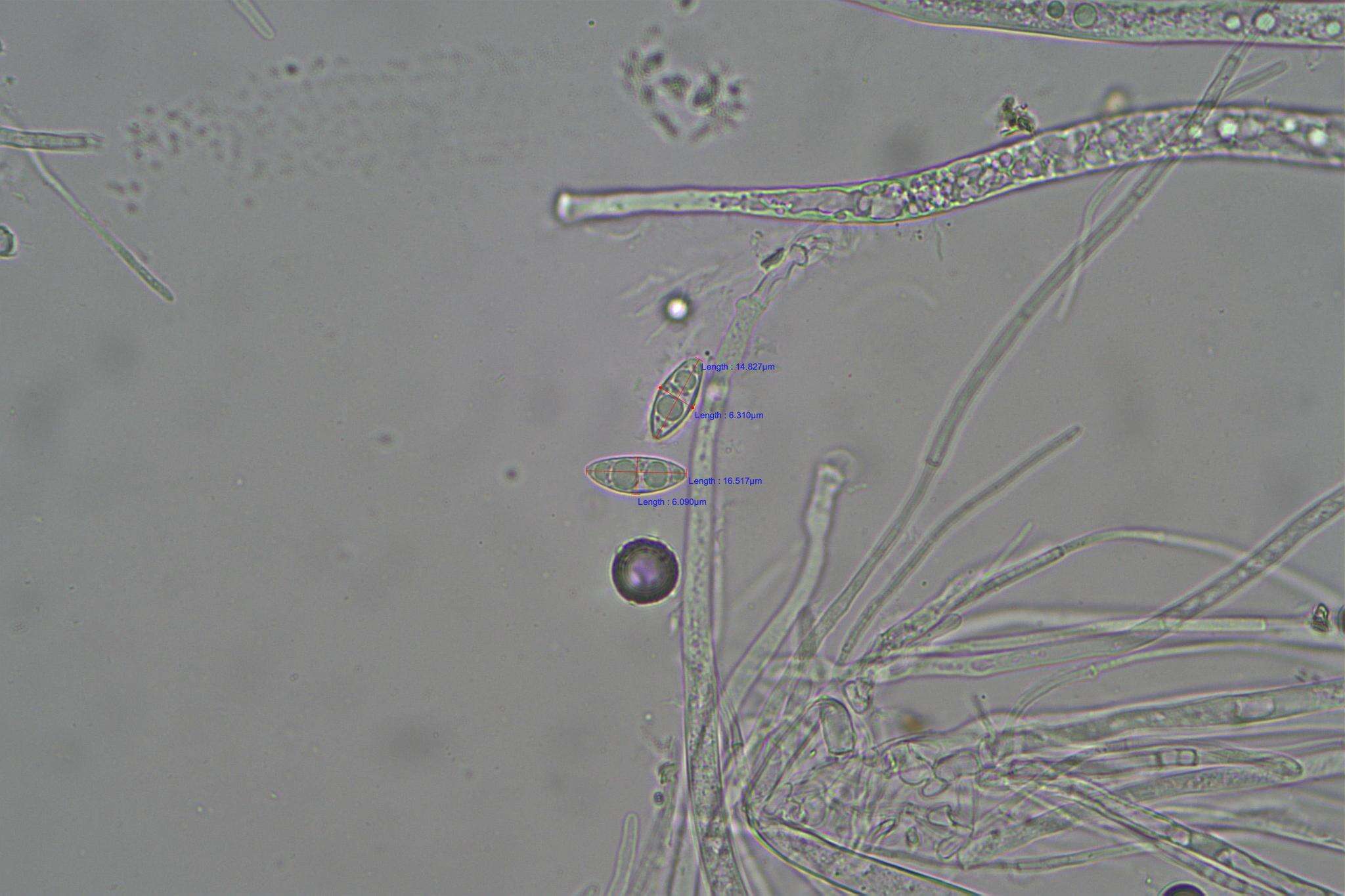 Image of Phaeohelotium undulatum (Rodway) Baral, R. Galán & Tena 2013