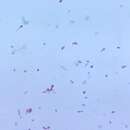 Image of Clostridium tertium