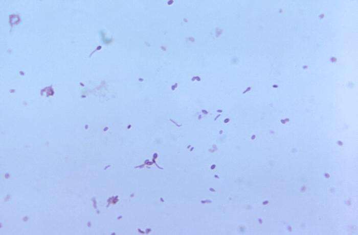 Image de Clostridium tertium