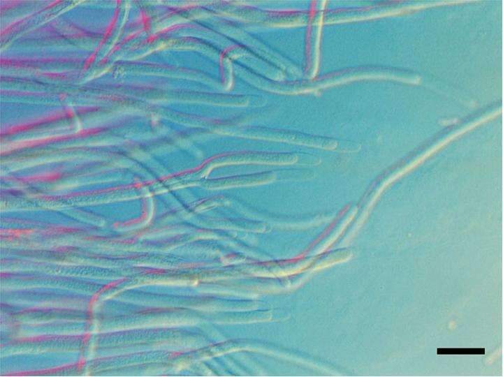 Слика од Dipodascus geotrichum (E. E. Butler & L. J. Petersen) Arx 1977