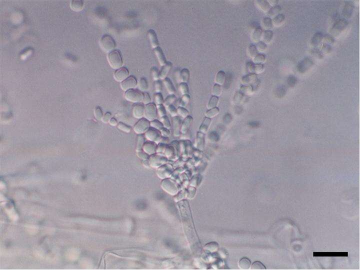 Слика од Dipodascus geotrichum (E. E. Butler & L. J. Petersen) Arx 1977