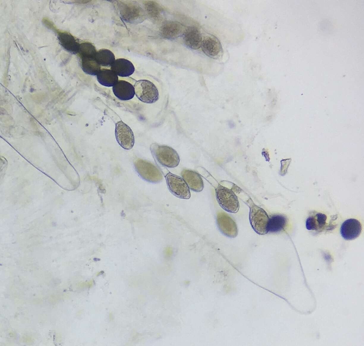 Image de Podospora pyriformis (A. Bayer) Cain 1962