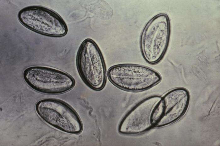 Image of Pinworm