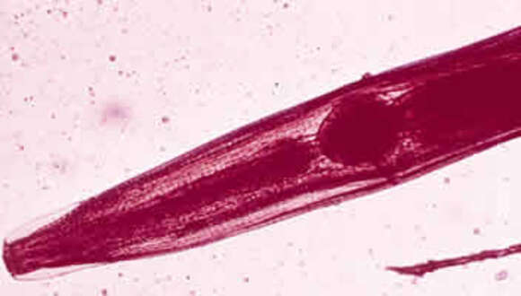 Image of Pinworm