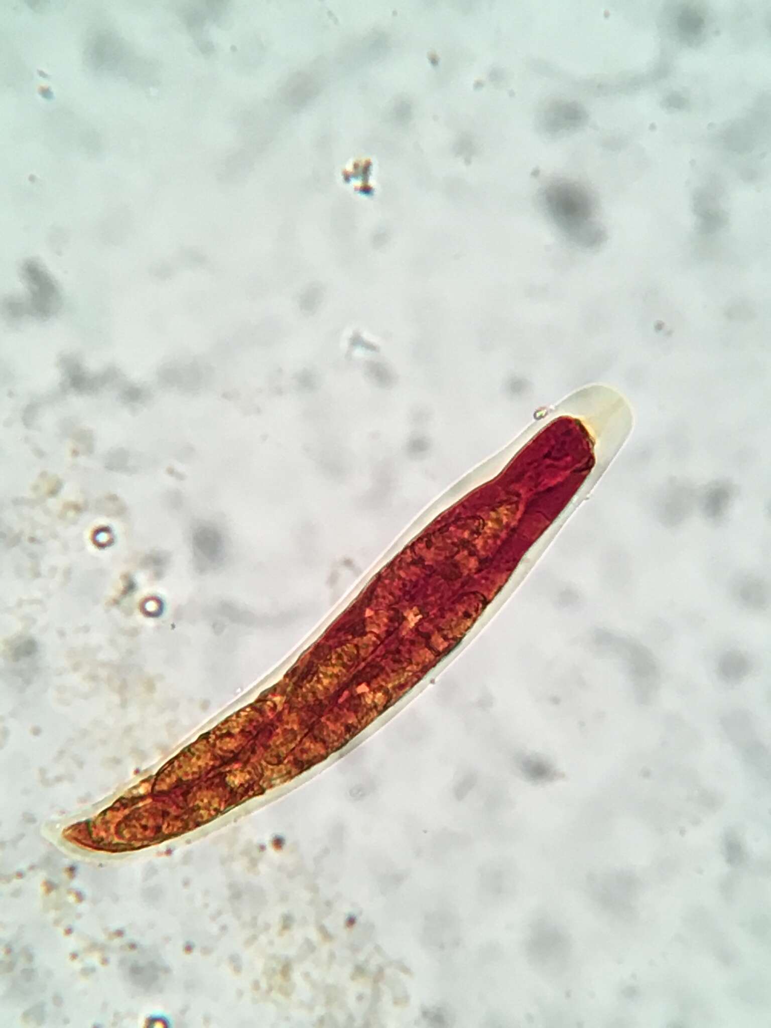 Prosthecium appendiculatum (G. H. Otth) M. E. Barr 1978的圖片