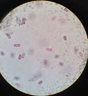 Image of purple sulfur bacteria and relatives