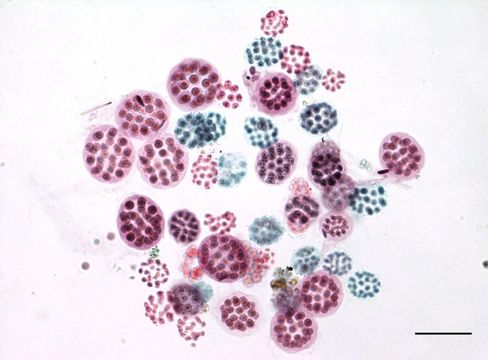 Image of Eudorina