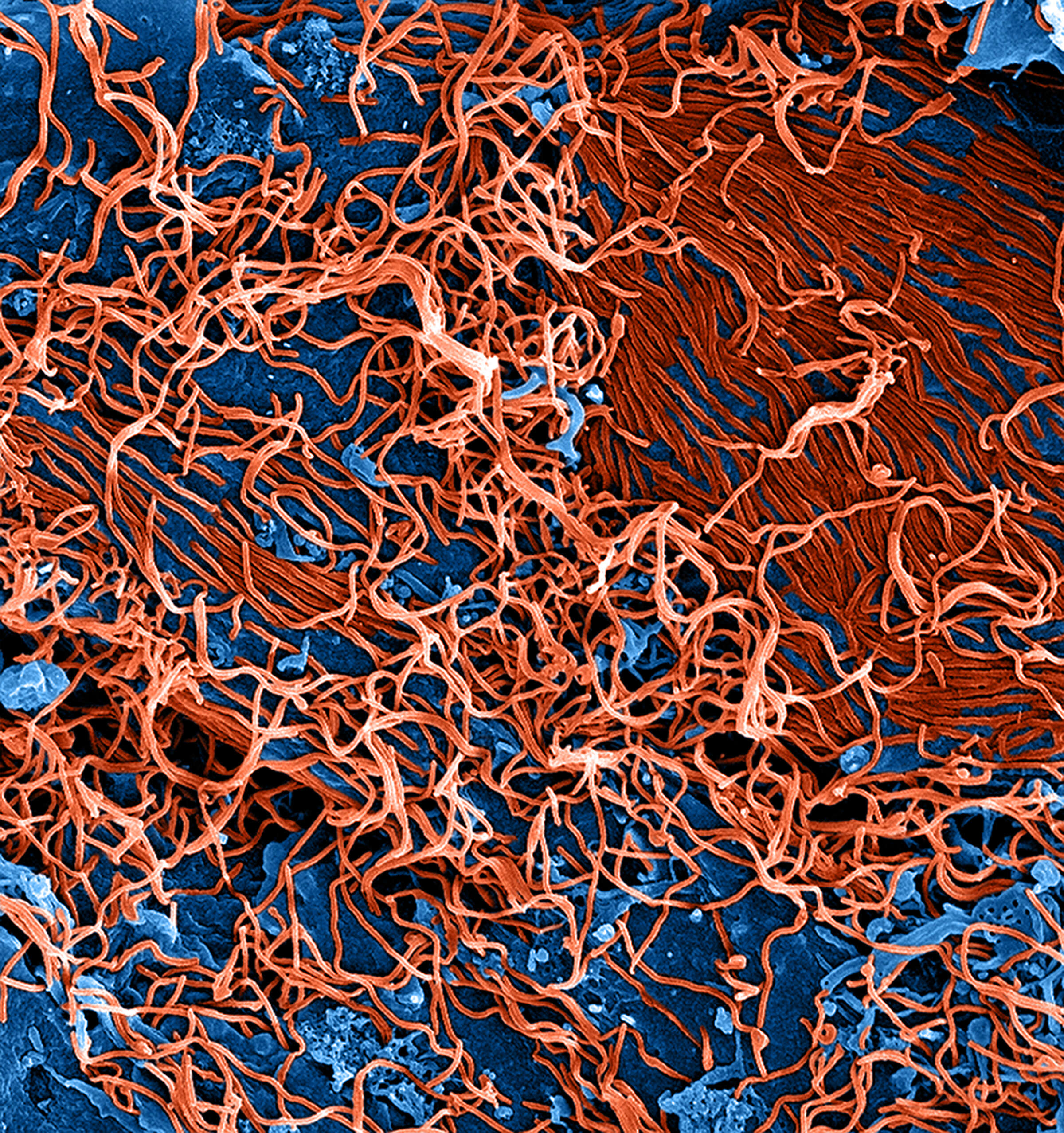 Sivun Zaire ebolavirus kuva