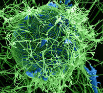 Image of Zaire ebolavirus