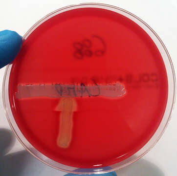 Plancia ëd Streptococcus agalactiae