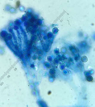 Image of Microascus brevicaulis S. P. Abbott 1998