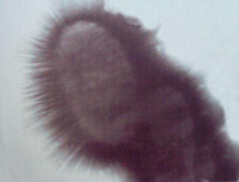 Image of Pseudomonas aeruginosa