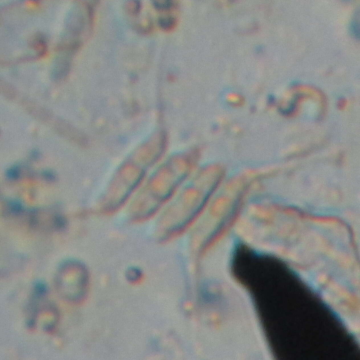 Image of Desmodesmus (R. Chodat) S. S. An, T. Friedl & E. Hegewald 1999