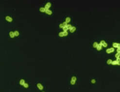 Image of Streptococcus pneumoniae