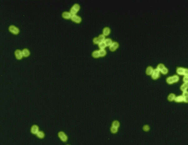 Imagem de Streptococcus pneumoniae