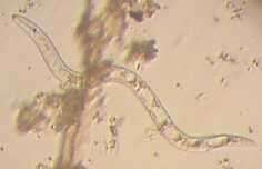 Image of nematodes